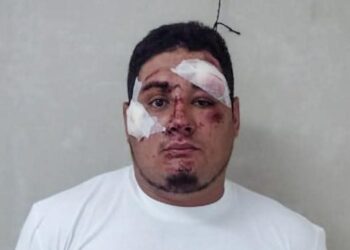 Detenido sujeto en estado de ebriedad