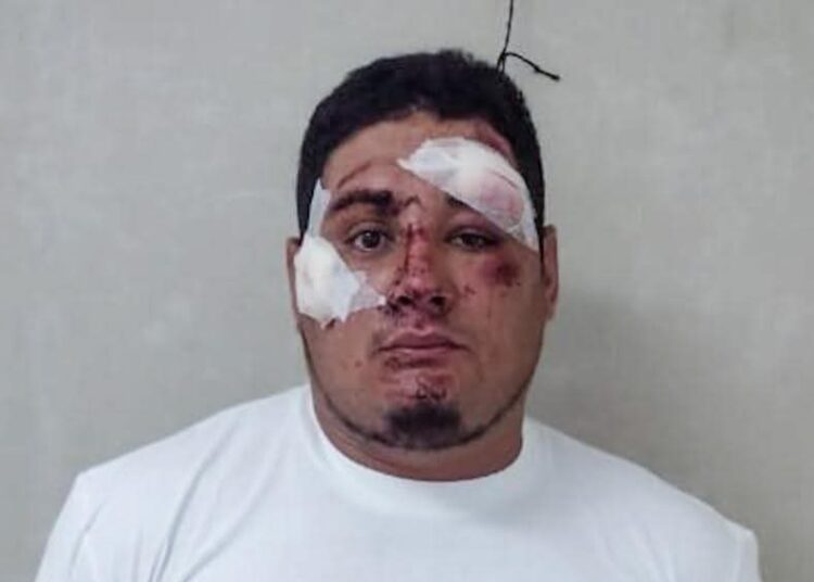 Detenido sujeto en estado de ebriedad