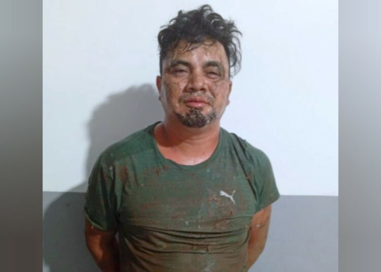 Mujer embarazada sobrevive a ataque con arma blanca en Usulután