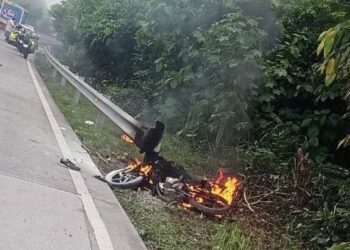 Joven motociclista se accidenta y termina con quemaduras en casi todo su cuerpo