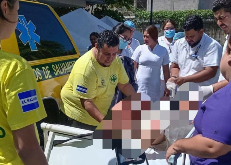 Joven sufre graves quemaduras tras explosión accidental mientras quemaba basura