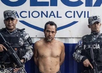 Capturan a pandillero que trató de camuflarse borrando sus tatuajes