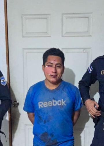 Pandillero de la MS13 resulta lesionado en accidente y será procesado por agrupaciones ilícitas