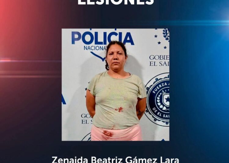 Agresión con botella en Soyapango deja un lesionado y una mujer detenida