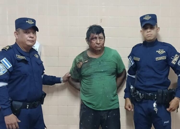 Capturan a motociclista que atropelló a una persona mientras conducía ebrio