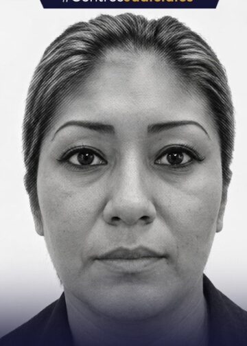 Abren proceso judicial contra dueña de perro que atacó a un hombre en Santa Ana